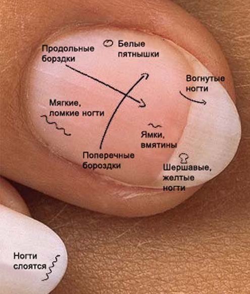 У меня на ногтях черные пятна У меня на ногтях черные пятна